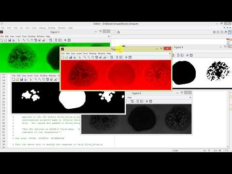 Blood Group Detection Using Image Processing Matlab Project Code | Human Blood Group Classification