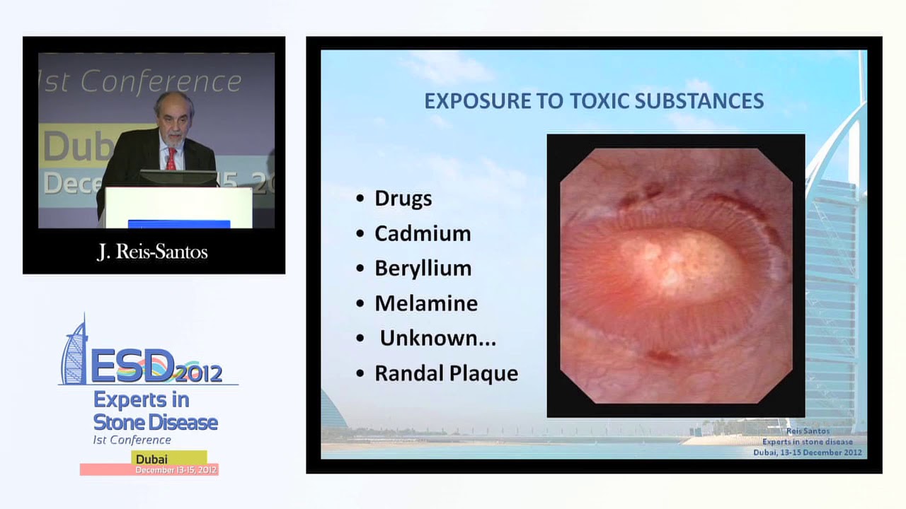 Stone research Epidemiology of stone disease in the Western world
