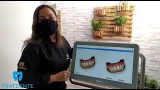 Tratdente - Escaneamento Intraoral