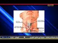 الغده الدرقيه السامه الاعراض والعلاج د عبدالله الدليمي الغده الدرقيه السامه الاعراض والعلاج د عبدالله الدليمي