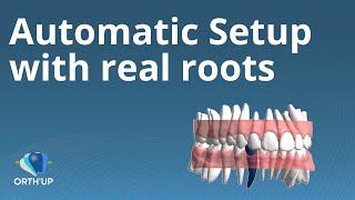 Automatic setup | ORTH'UP new interface