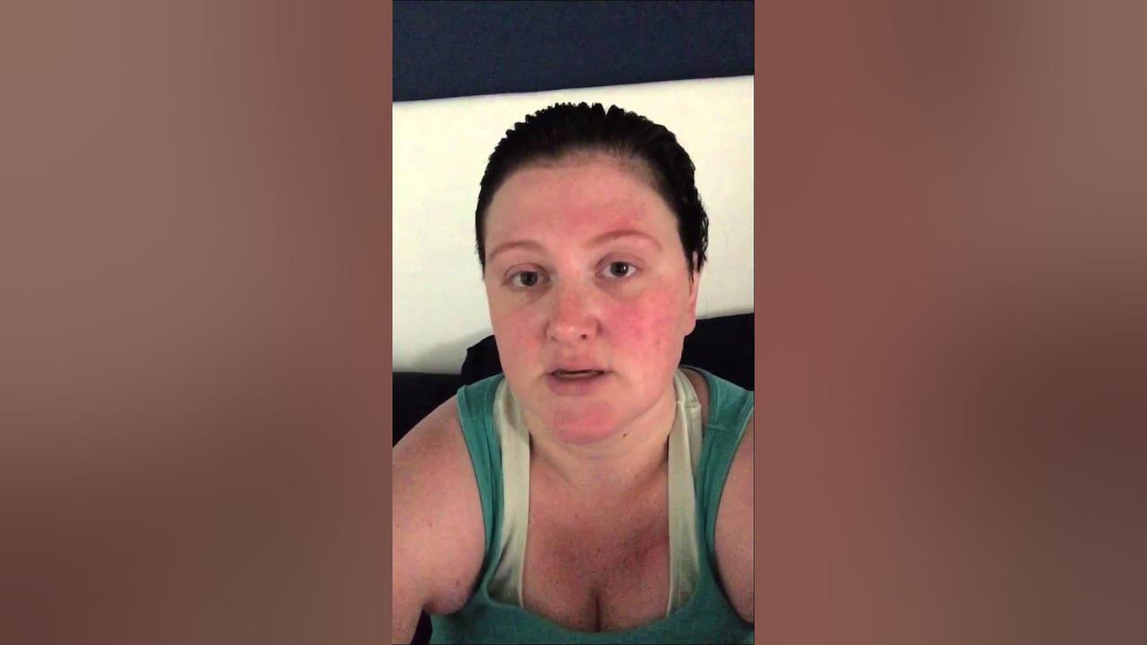 working-out-after-brain-surgery-youtube