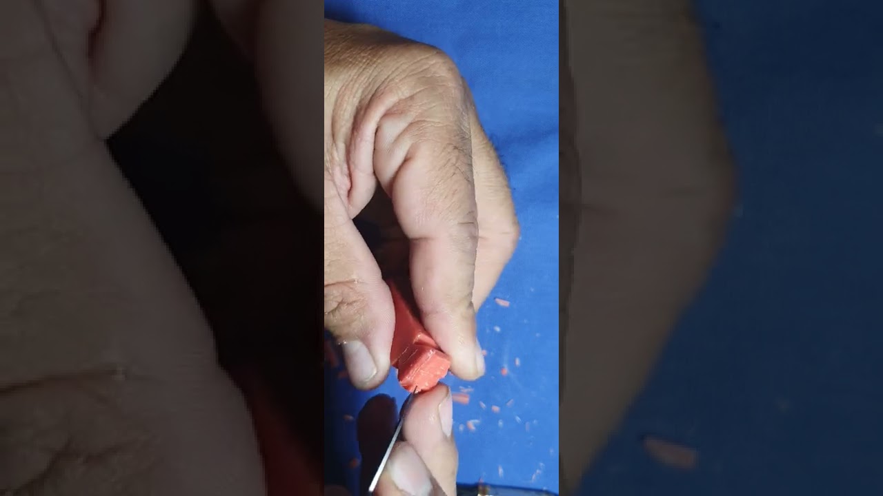 Tallado del Primer Molar Inferior