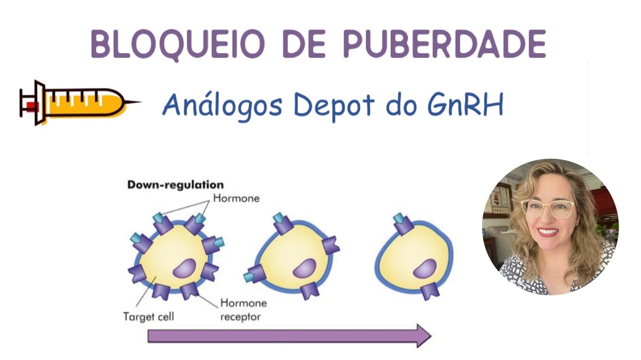 76 - Bloqueio da Puberdade: quando está indicado?