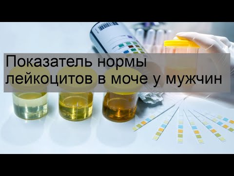 Показатель нормы лейкоцитов в моче у мужчин