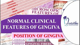Position of gingiva| Active Passive eruption| Clinical Anatomical crown &root |Periodontics|Carranza