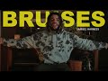 Bruises - Lewis Capaldi (Cover By Samuel Harness)