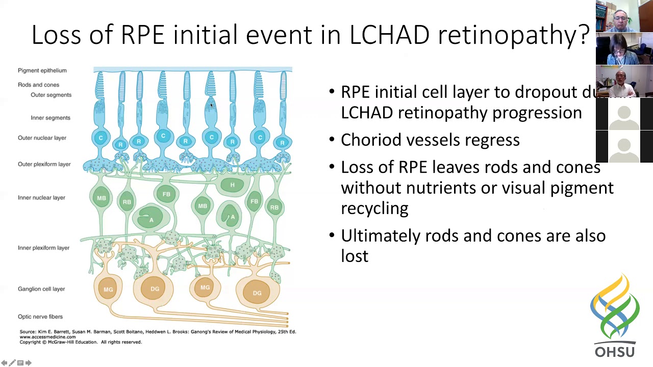 Loss of retinal pigment epithelium (RPE)