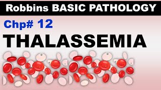 Ch12 | Thalassemias | α-Thalassemia | β-Thalassemia | Blood Pathology | Dr Asif Lectures