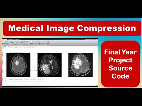 Medical Image Compression Using Matlab | Medical Image Compression Using Image Processing