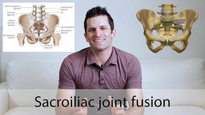 SI-LOK® Sacroiliac Joint Fixation System 