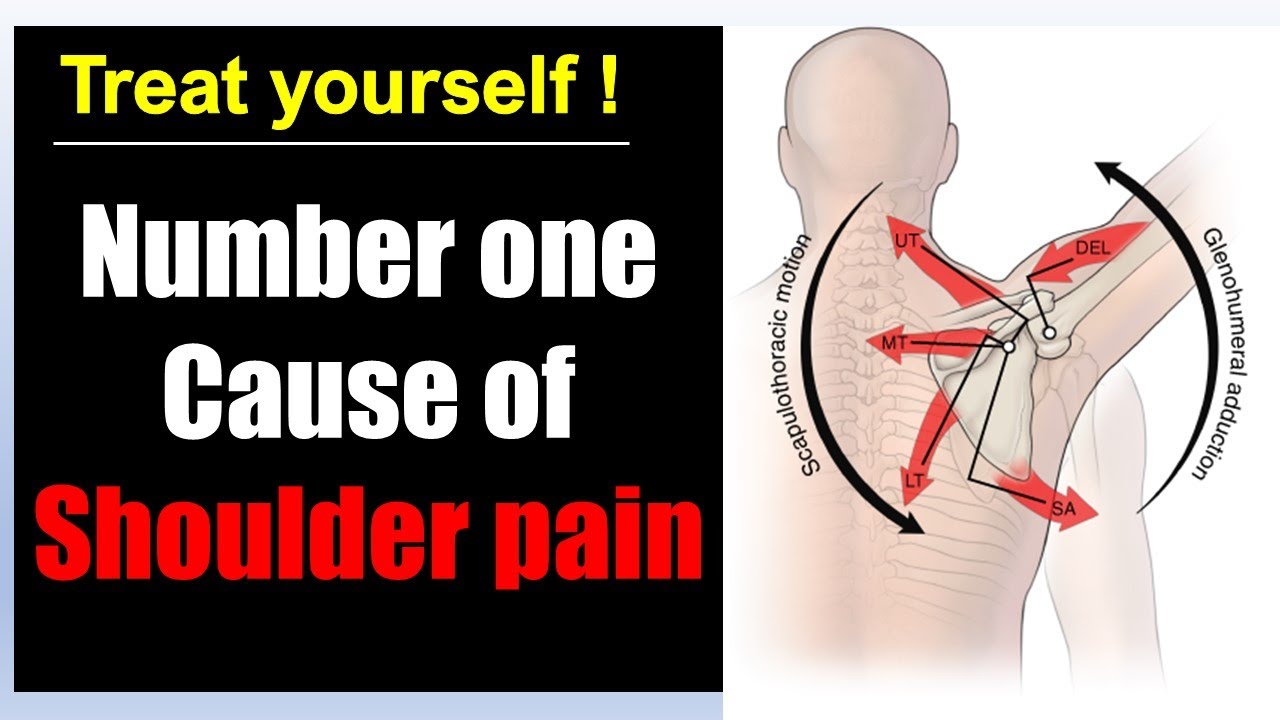 Fix shoulder snapping and pain: rotator pain rehab massage treatment exercises - YouTube