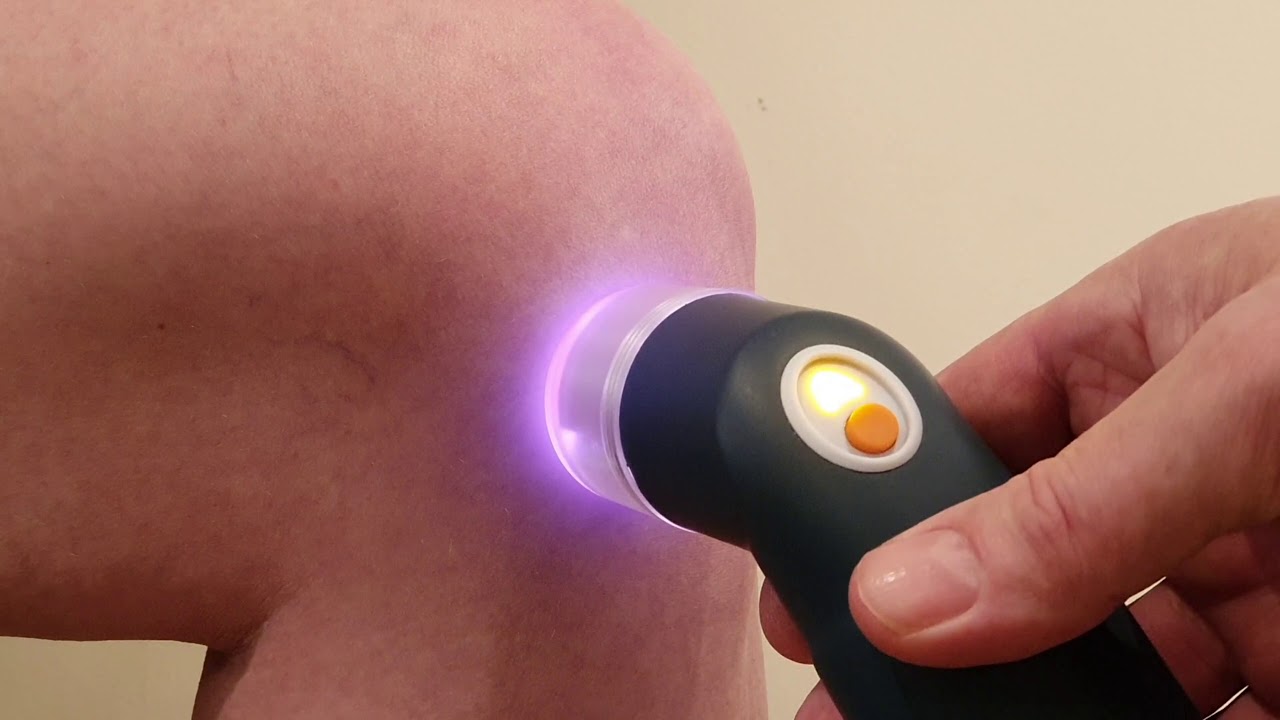Knee joint low level laser treatment (LLLT) for arthritis YouTube