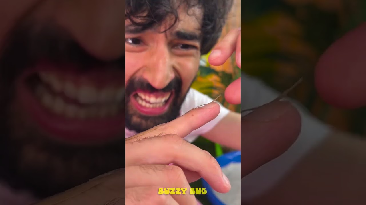 Nail Biting Adventures: The Hangnail Dilemma! ✋😱