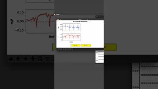 ECG signal denoising using Python | Data Processing | Electrophysiology | Electrocardiography
