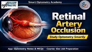 Part-1: What is Retinal Artery Occlusion? | CRAO vs BRAO Explained | Eye Pathology