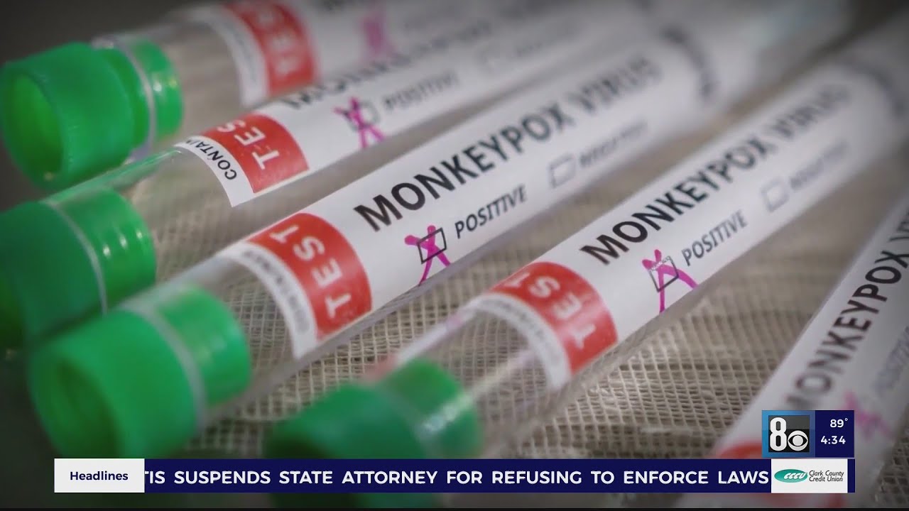SNDH monkeypox update following declaration of public health emergency ...