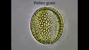 pollen in honey under a microscope #microscopic#microscope#science#nature#food#honey#bee#pollen#bio