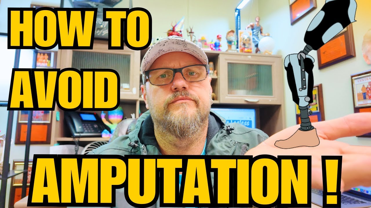 HOW TO AVOID AMPUTATION (From An Amputee)