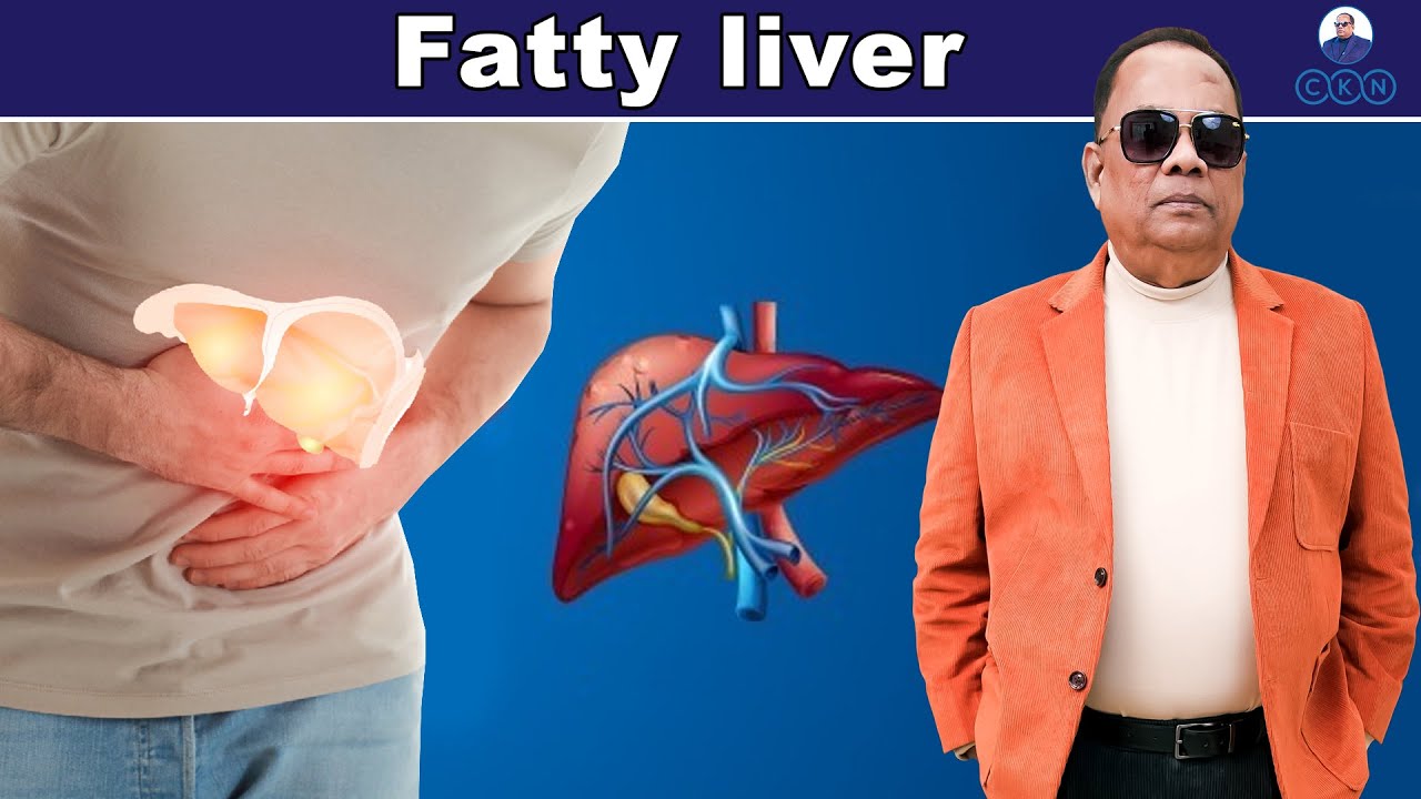 FATTY LIVER / CKN