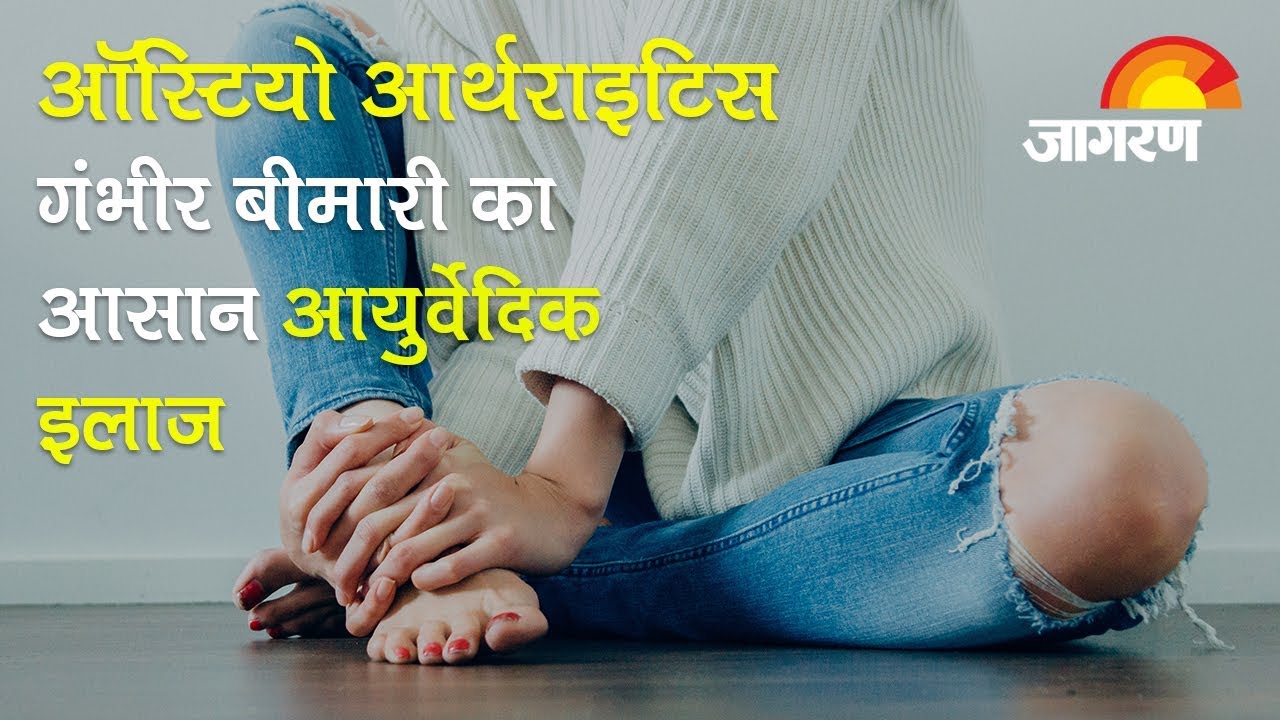 Ayurvedic Treatment of Osteoarthritis: ऑस्टियो आर्थराइटिस गंभीर बीमारी का आयुर्वेदिक इलाज