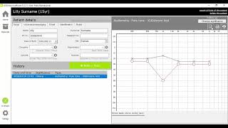 Audiograms   Clinical Reports    Kuduwave Audiometer