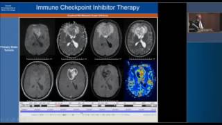 Recent Developments in Neuro-Oncology