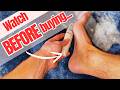 I Tested Upgraded Electric Callus Removers for Feet… Here’s the Truth! 🕵️‍♀️📢