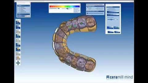 Virtual articulator ENGLISH