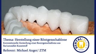 Konventionelle Zahntechnik - FREE FULL VIDEO - Herstellung einer Röntgenschablone