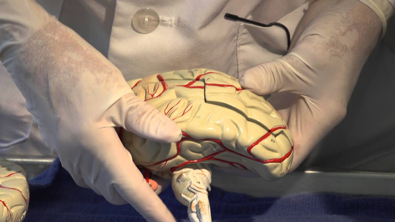 Cerebral Circulation: Neuroanatomy Video Lab - Brain Dissections