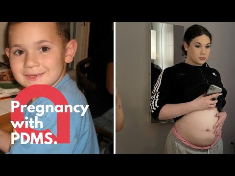 A teen born with male genitalia is pregnant after finding she has working ovaries and uterus | SWNS