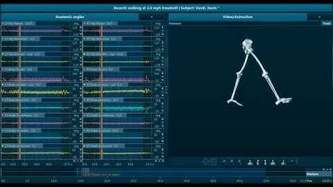 Walking gait analysis