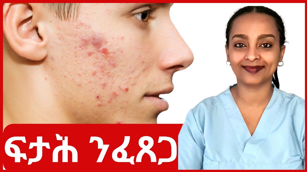 ፈጸጋ፡ ምሉእ ሕክምናዊ ሓበሬታ #ዶክተርሻሮን