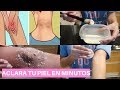 ACLARA TU ZONA INTIMA (ENTREPIERNA) CON ESTAS MASCARILLAS (DIY)