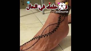 رؤيا الحنه في المنام💅