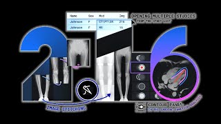 New features of Inobitec DICOM Viewer 2.16