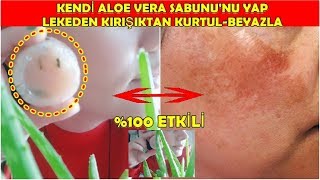 EN GÜZEL CİLT TEMİZLEYİCİ!1 KEZ SÜR BEYAZLA😲EV YAPIMI KIRIŞIKLIK GİDEREN-LEKE AÇAN ALOE VERA SABUNU Resimi