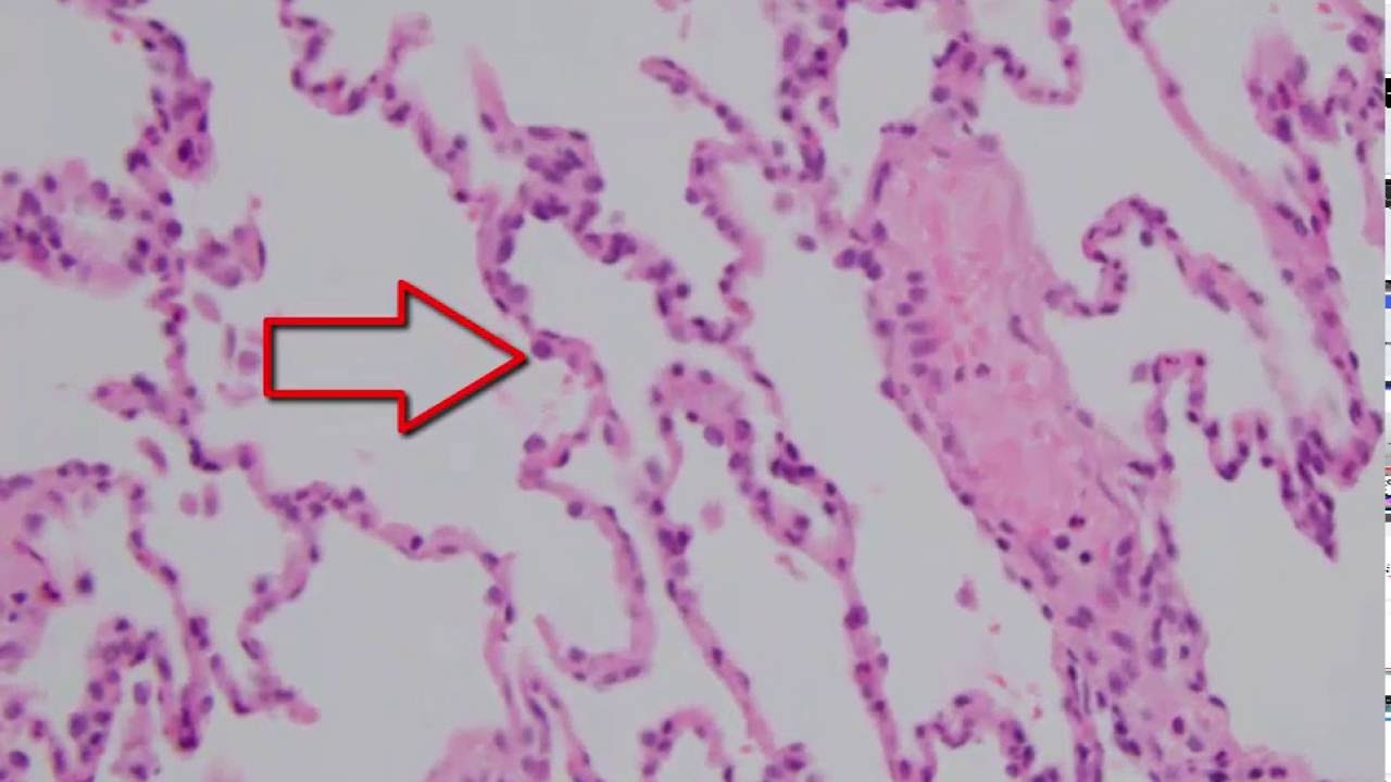 Histology of the Lung - YouTube