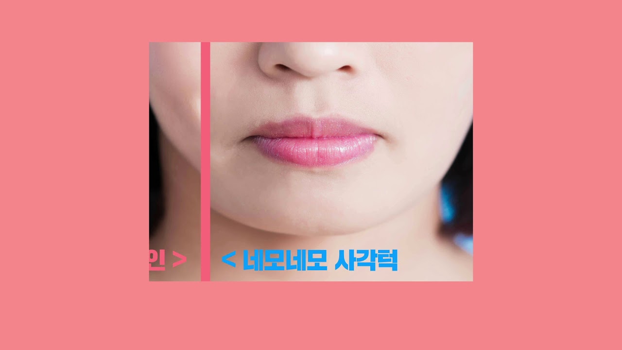 [Phẫu thuật thẩm mỹ Apex] Phẫu thuật thẩm mỹ hai cằm Apex_Dự án khuôn mặt V-line