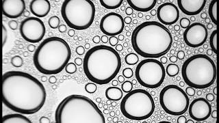 Nucleation and Growth of Micro-Sized Water Droplets (Condensation and Accumulation)