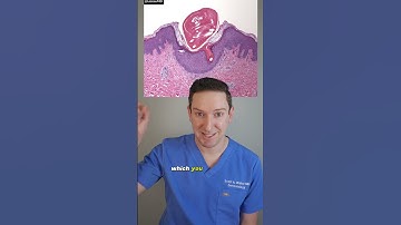 Thumbnail of Dermatologist explains KERATOSIS PILARIS: What Works? #keratosispilaris #chickenskin #bumpyskin