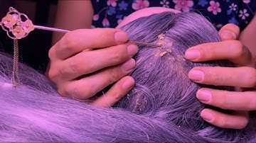 ASMR Dandruff Scratching🤩, Dandruff Removal🤯 & Tingly Scalp Check & Relaxing Crispy Sounds(2 ver)