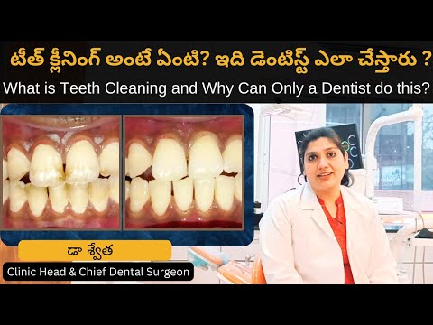 Difference between Teeth Cleaning & Teeth Whitening? in Telugu | Dr Swetha |