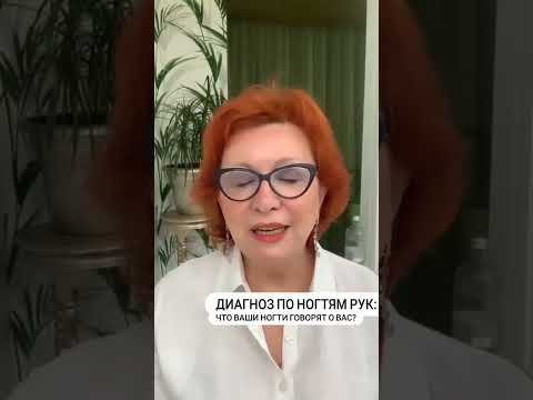 Диагноз ЗДОРОВЬЯ по НОГТЯМ рук: ЧТО ваши НОГТИ расскажут о вас?