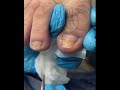 Satisfying Pedicure Routine | Gentle Toenail Care #fypシ #fypシ #pedicure #nailcare