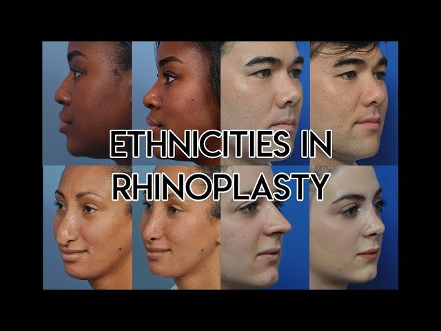 Ethnicities in Rhinoplasty