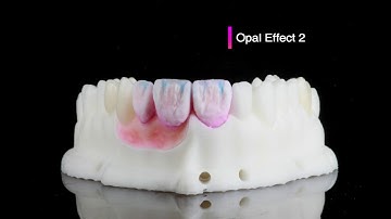 DORIOT DENT - IPS e.max ZirCAD MT multi - "HOW TO"