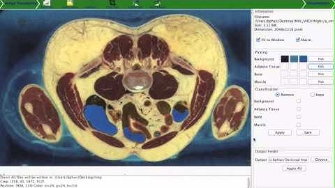Using VTK in the Reconstruction of the Human Body