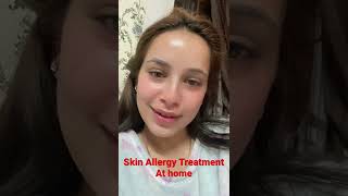 Skin Allergy Treatment At Home #poonamthakur325 screenshot 4